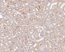 Invitrogen AIMP2 Polyclonal Antibody 100 &mu;L; Unconjugated:Antibodies,