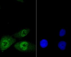 Invitrogen GLI1 Polyclonal Antibody 100 &mu;L; Unconjugated:Antibodies,
