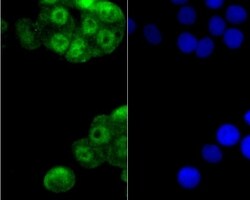 Invitrogen GLI1 Polyclonal Antibody 100 &mu;L; Unconjugated:Antibodies,