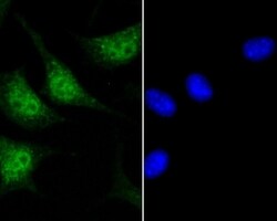 Invitrogen GLI1 Polyclonal Antibody 100 &mu;L; Unconjugated:Antibodies,