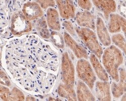 Invitrogen GLI1 Polyclonal Antibody 100 &mu;L; Unconjugated:Antibodies,