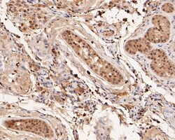 Invitrogen GLI1 Polyclonal Antibody 100 &mu;L; Unconjugated:Antibodies,