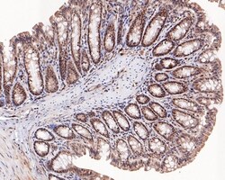 Invitrogen KDM2A Polyclonal Antibody 100 &mu;L; Unconjugated:Antibodies,
