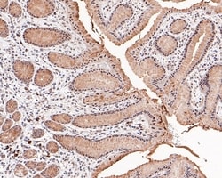 Invitrogen KDM2A Polyclonal Antibody 100 &mu;L; Unconjugated:Antibodies,