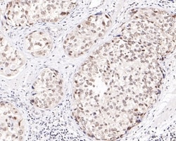 Invitrogen TBP Polyclonal Antibody 100 &mu;L; Unconjugated:Antibodies,
