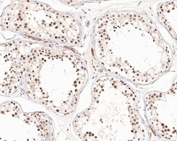 Invitrogen TBP Polyclonal Antibody 100 &mu;L; Unconjugated:Antibodies,