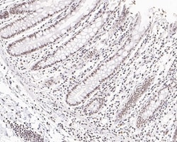 Invitrogen TBP Polyclonal Antibody 100 &mu;L; Unconjugated:Antibodies,