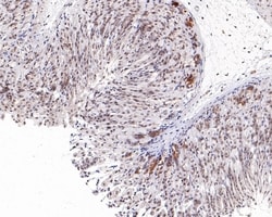 Invitrogen TBP Polyclonal Antibody 100 &mu;L; Unconjugated:Antibodies,