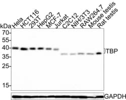 Invitrogen TBP Polyclonal Antibody 100 &mu;L; Unconjugated:Antibodies,