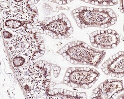 Invitrogen KDM6A Polyclonal Antibody 100 &mu;L; Unconjugated:Antibodies,