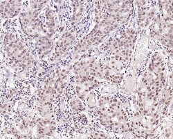 Invitrogen WTAP Polyclonal Antibody 100 &mu;L; Unconjugated:Antibodies,