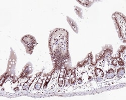 Invitrogen WTAP Polyclonal Antibody 100 &mu;L; Unconjugated:Antibodies,