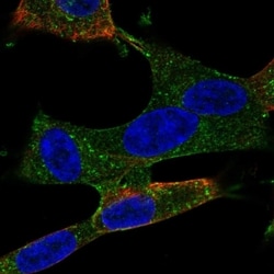 Invitrogen TEM5 Polyclonal Antibody 100 &mu;L; Unconjugated:Antibodies,