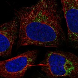 Invitrogen C17orf80 Polyclonal Antibody 100 &mu;L | Buy Online | Invitrogen&trade; | Fisher Scientific