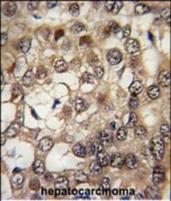 Invitrogen HIPK2 Polyclonal Antibody 400 &mu;L; Unconjugated:Antibodies,