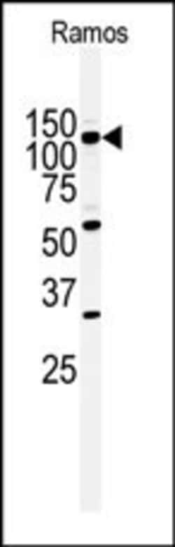 Invitrogen HIPK2 Polyclonal Antibody 400 &mu;L; Unconjugated:Antibodies,