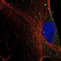 Invitrogen Monoacylglycerol Lipase Polyclonal Antibody 100 &mu;L; Unconjugated:Antibodies,