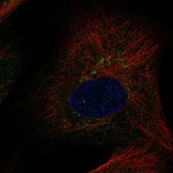 Invitrogen Glypican 6 Polyclonal Antibody 100 &mu;L; Unconjugated:Antibodies,
