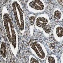 Invitrogen RALGPS1 Polyclonal Antibody 100 &mu;L; Unconjugated:Antibodies,