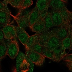 Invitrogen HDAC10 Polyclonal Antibody 100 &mu;L; Unconjugated:Antibodies,