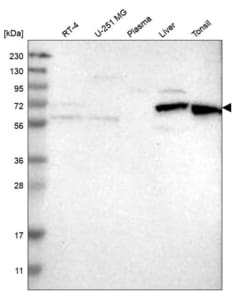 Invitrogen HDAC10 Polyclonal Antibody 100 &mu;L; Unconjugated:Antibodies,