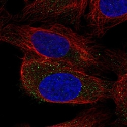 Invitrogen ENTHD2 Polyclonal Antibody 100 &mu;L; Unconjugated:Antibodies,