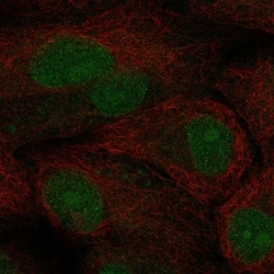 Invitrogen TCF21 Polyclonal Antibody 100 &mu;L; Unconjugated:Antibodies,