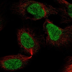 Invitrogen ZNF496 Polyclonal Antibody 100 &mu;L; Unconjugated:Antibodies,