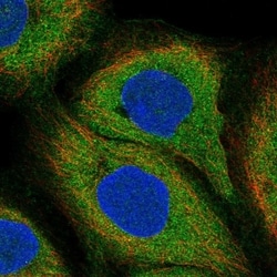 Invitrogen LILRB3 Polyclonal Antibody 100 &mu;L; Unconjugated:Antibodies,