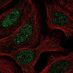 Invitrogen SNAPC4 Polyclonal Antibody 100 &mu;L; Unconjugated:Antibodies,