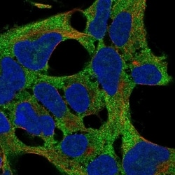 Invitrogen RPS11 Polyclonal Antibody 100 &mu;L; Unconjugated:Antibodies,