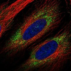 Invitrogen VWDE Polyclonal Antibody 100 &mu;L; Unconjugated:Antibodies,