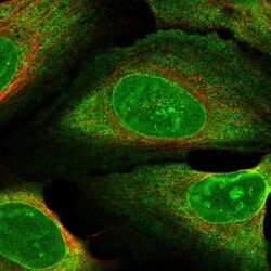 Invitrogen ZNF474 Polyclonal Antibody 100 &mu;L; Unconjugated:Antibodies,