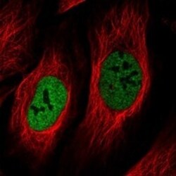 Invitrogen NEK5 Polyclonal Antibody 100 &mu;L; Unconjugated:Antibodies,