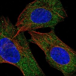 Invitrogen RBM46 Polyclonal Antibody 100 &mu;L; Unconjugated:Antibodies,