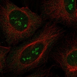 Invitrogen RBM46 Polyclonal Antibody 100 &mu;L; Unconjugated:Antibodies,
