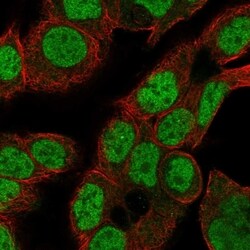 Invitrogen CDK2AP2 Polyclonal Antibody 100 &mu;L; Unconjugated:Antibodies,