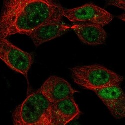 Invitrogen CCDC169 Polyclonal Antibody 100 &mu;L | Buy Online | Invitrogen&trade; | Fisher Scientific