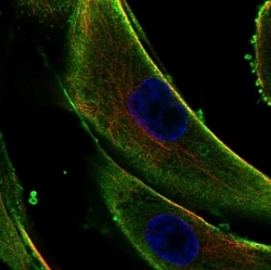 Invitrogen COL5A3 Polyclonal Antibody 100 &mu;L; Unconjugated:Antibodies,