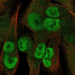 Invitrogen KCTD15 Polyclonal Antibody 100 &mu;L; Unconjugated:Antibodies,