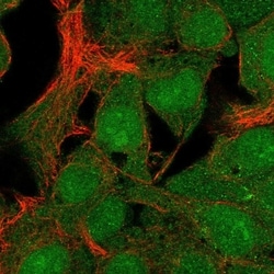 Invitrogen C19orf67 Polyclonal Antibody 100 &mu;L; Unconjugated:Antibodies,