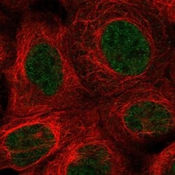 Invitrogen MSANTD1 Polyclonal Antibody 100 &mu;L; Unconjugated:Antibodies,