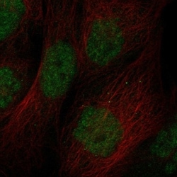 Invitrogen ZBTB46 Polyclonal Antibody 100 &mu;L; Unconjugated:Antibodies,