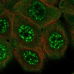 Invitrogen KIAA1328 Polyclonal Antibody 100 &mu;L | Buy Online | Invitrogen&trade; | Fisher Scientific