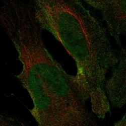 Invitrogen CHRNA2 Polyclonal Antibody 100 &mu;L; Unconjugated:Antibodies,