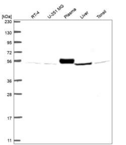 Invitrogen SLC38A7 Polyclonal Antibody 100 &mu;L | Buy Online | Invitrogen&trade; | Fisher Scientific