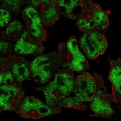 Invitrogen UBASH3A Polyclonal Antibody 100 &mu;L; Unconjugated:Antibodies,