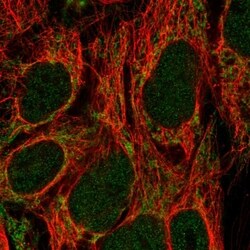 Invitrogen CDK5RAP1 Polyclonal Antibody 100 &mu;L; Unconjugated:Antibodies,
