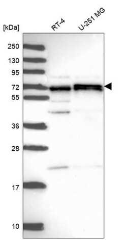 Invitrogen CDK5RAP1 Polyclonal Antibody 100 &mu;L; Unconjugated:Antibodies,