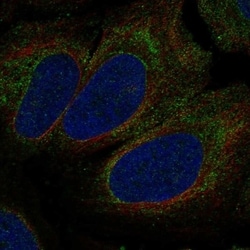 Invitrogen P2X1 Polyclonal Antibody 100 &mu;L; Unconjugated:Antibodies,